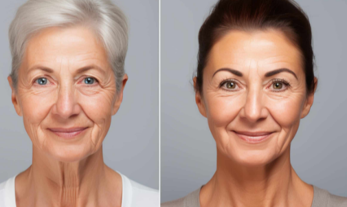 Btx Clinic Monterey Park Ca: Common Questions, Risks, and Better Comparison Criteria